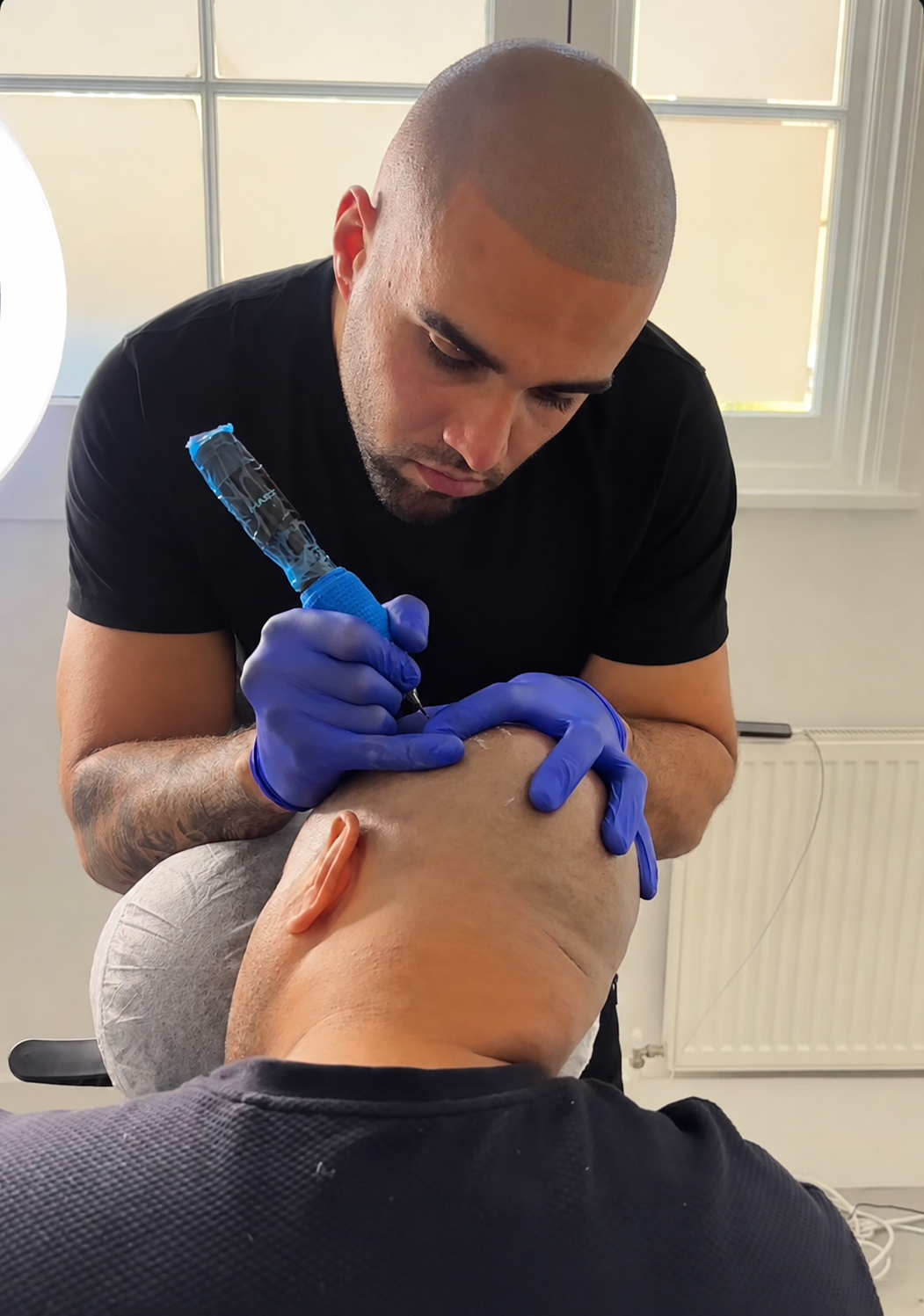 Charlie performing SMP treatment